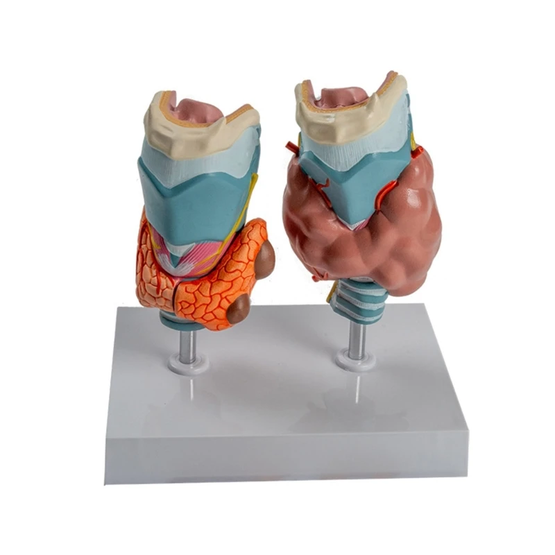 Pathological Thyroid Anatomy Model with Removable Parts for Lecture Report Educational Use, Anatomical Thyroid Model
Pathological Thyroid Anatomy Model with Removable Parts for Lecture Report Educational Use, Anatomical Thyroid Model