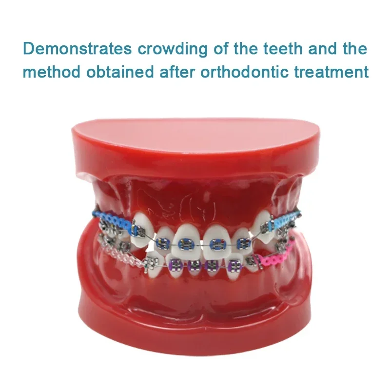 Orthodontics Teeth Model Dentals Typodonts Orthodontics Teeth Model 1:1 Standards Demo Dentals Supplies
Orthodontics Teeth Model Dentals Typodonts Orthodontics Teeth Model 1:1 Standards Demo Dentals Supplies