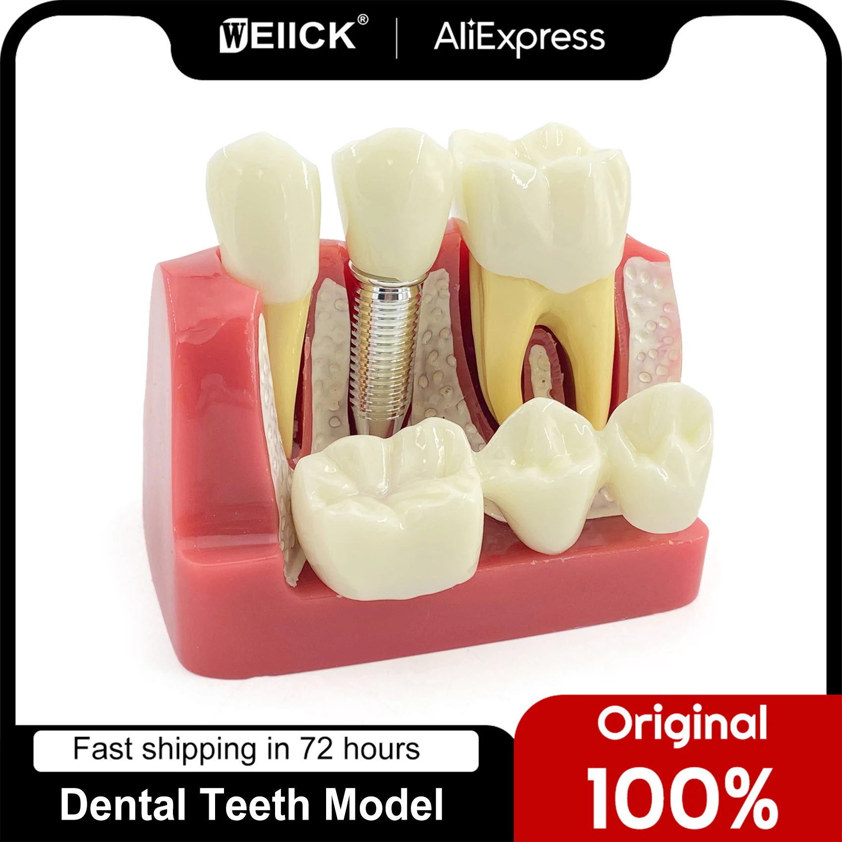 WellCK Dental Teaching Implant Analysis Crown Bridge Removable Model Dental Demonstration Teeth Model
WellCK Dental Teaching Implant Analysis Crown Bridge Removable Model Dental Demonstration Teeth Model