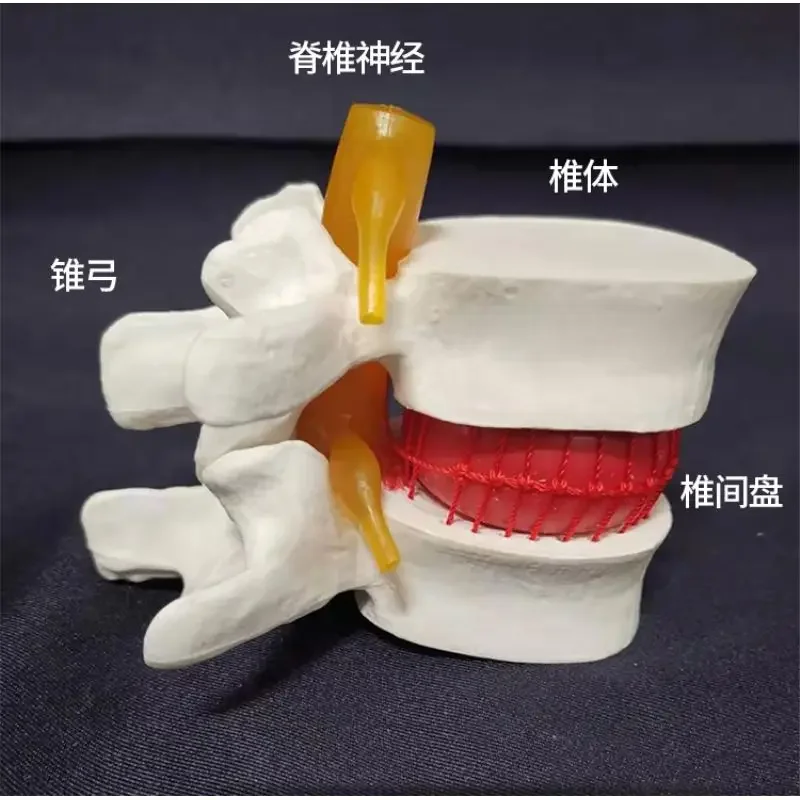 Medical Human Lumbar Protrusion Spinal Vertebral Pathology Demonstration Joint Standard Model
Medical Human Lumbar Protrusion Spinal Vertebral Pathology Demonstration Joint Standard Model