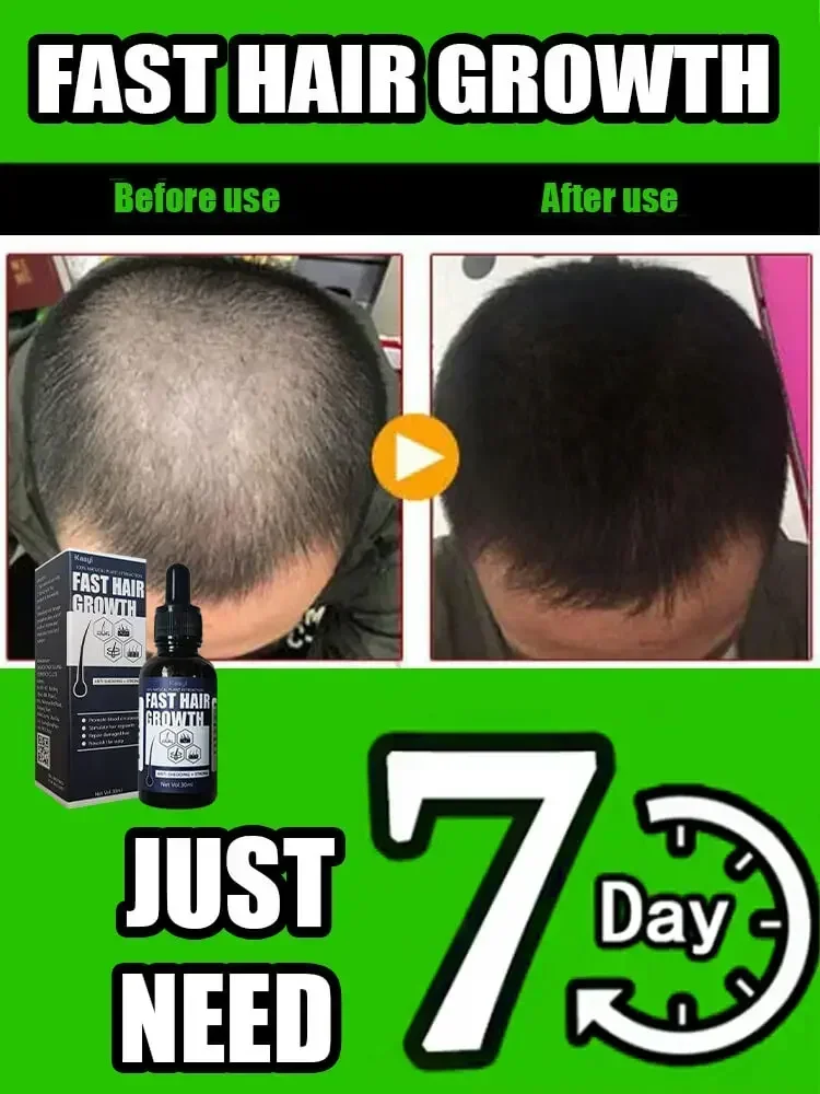 Faster Stronger Thicker Hair Growth | Clinically Tested for Thicker Hair | Rapid hair growth
Faster Stronger Thicker Hair Growth | Clinically Tested for Thicker Hair | Rapid hair growth
