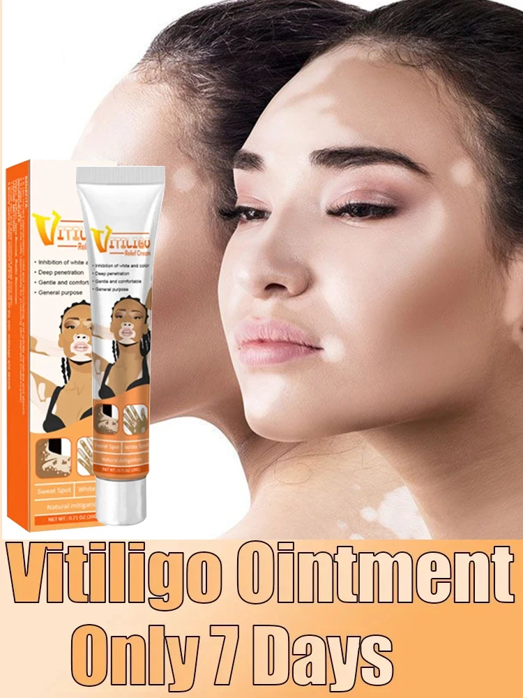 Effectively Remove Vitiligo Ointment Ringworm White Spot Removal Skin Vitiligo Eliminate Vitiligo Skin Care
Effectively Remove Vitiligo Ointment Ringworm White Spot Removal Skin Vitiligo Eliminate Vitiligo Skin Care