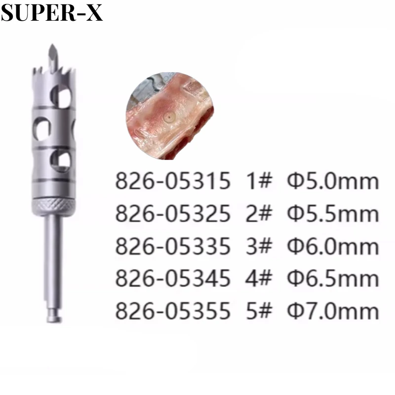 Dental Implant Bone Extraction Drill Hollow Anti Slip Band Positioning Bone Block Ring Cutting Drill Dental Surgical Tools
Dental Implant Bone Extraction Drill Hollow Anti Slip Band Positioning Bone Block Ring Cutting Drill Dental Surgical Tools