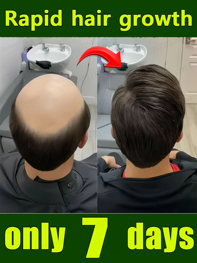 The best-selling hair growth product in Asia. From today, you will no longer be troubled by hair loss and baldness. Find your be
The best-selling hair growth product in Asia. From today, you will no longer be troubled by hair loss and baldness. Find your be