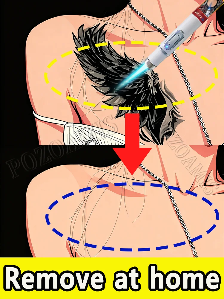 Удаление пигментных накладок, почти цвет, черный. Удаление форм татуировок и размеров дома.
Удаление пигментных накладок, почти цвет, черный. Удаление форм татуировок и размеров дома.