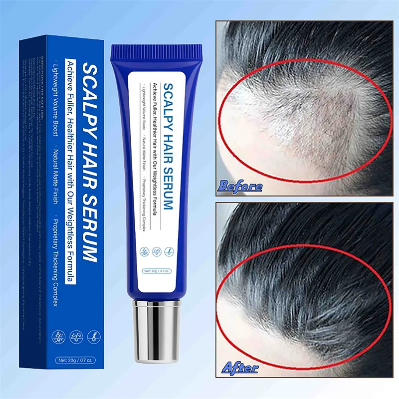 20g Scalpy Hair Serum Fast Growth Oil Africa Crazy Traction Alopecia Anti Hair Break Thicken Hair Loss Treatment For Man Women
20g Scalpy Hair Serum Fast Growth Oil Africa Crazy Traction Alopecia Anti Hair Break Thicken Hair Loss Treatment For Man Women
