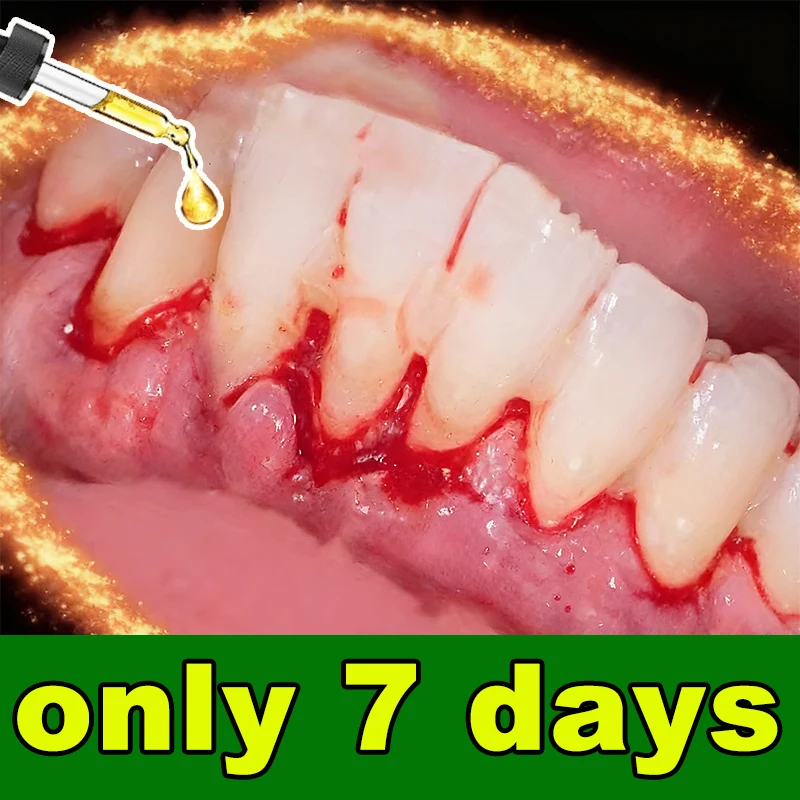 Скажи прощай, чтобы кровоточить и опухтить десны! Профессиональный ремонт пародонтита, быстро работает и восстанавливает здоровый, сильные десны.
Скажи прощай, чтобы кровоточить и опухтить десны! Профессиональный ремонт пародонтита, быстро работает и восстанавливает здоровый, сильные десны.