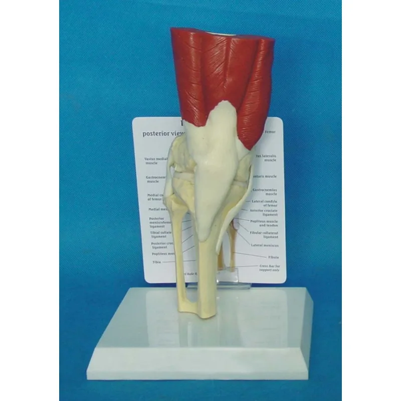 Анатомия 1:1 человека, коленный сустав, скелет, мышцы, анатомическая медицинская модель, учебные ресурсы, поставки
Анатомия 1:1 человека, коленный сустав, скелет, мышцы, анатомическая медицинская модель, учебные ресурсы, поставки