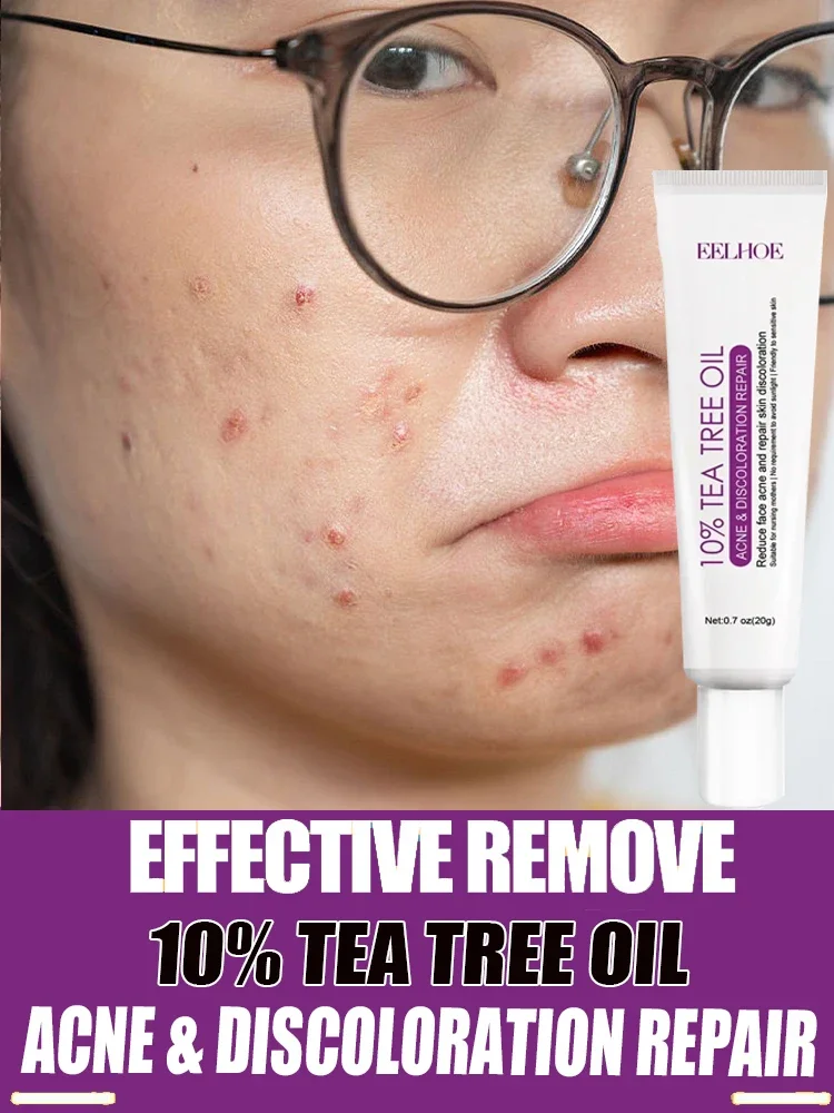 Tea Tree Acne Treatment Cream Pore Shrink Oil Control Whitening Repair Pimple Deep Cleaning Anti-acne Moisturizer Face Skin Care
Tea Tree Acne Treatment Cream Pore Shrink Oil Control Whitening Repair Pimple Deep Cleaning Anti-acne Moisturizer Face Skin Care