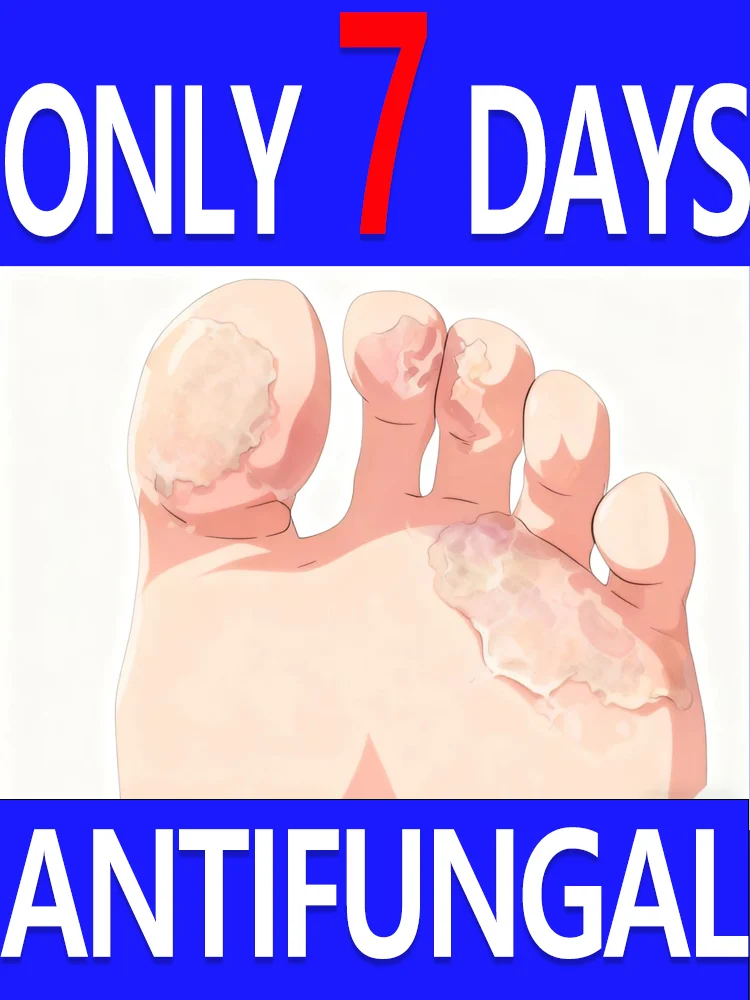 Sᴀʏ Gᴏᴏᴅʙʏᴇ ᴛᴏ ɪᴛᴄʜʏ Aɴᴅ Pᴇᴇʟɪɴɢ ғᴇᴇᴛ,enjoy a relaxed feeling.
Sᴀʏ Gᴏᴏᴅʙʏᴇ ᴛᴏ ɪᴛᴄʜʏ Aɴᴅ Pᴇᴇʟɪɴɢ ғᴇᴇᴛ,enjoy a relaxed feeling.