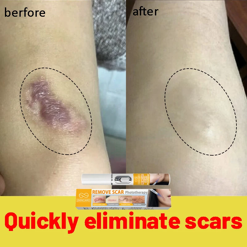 Быстрое удаление ожогов. Восстановление автомобиля. Мягкое отбеливание. Уход за кожей лица.
Быстрое удаление ожогов. Восстановление автомобиля. Мягкое отбеливание. Уход за кожей лица.