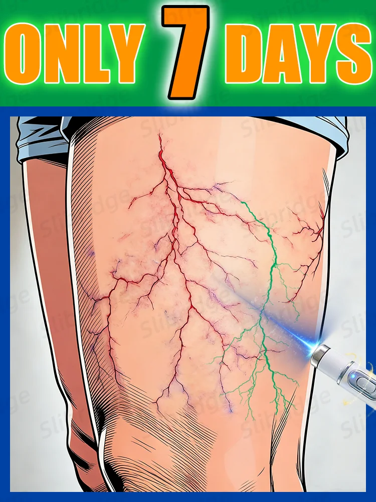 2-in-1 foot care tool,Say goodbye to leg troubles and spider veins.
2-in-1 foot care tool,Say goodbye to leg troubles and spider veins.