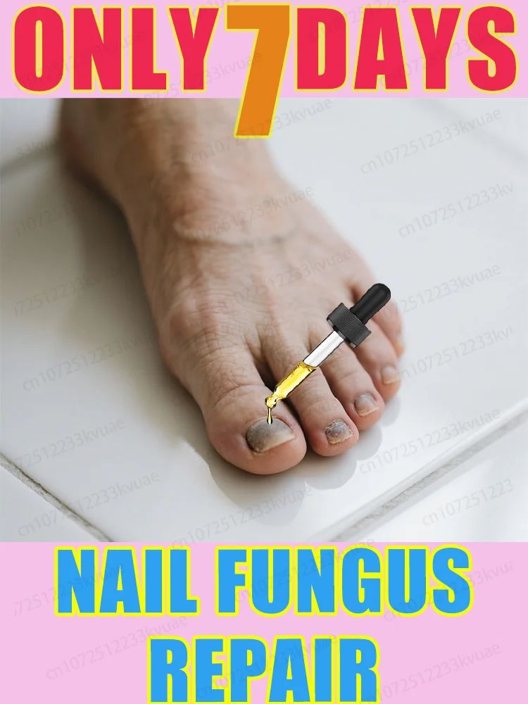 Nᴀɪʟ ғᴜɴɢᴜs ᴛʀᴇᴀᴛᴍᴇɴᴛ ᴇssᴇɴᴛɪᴀʟ ᴏɪʟ, ʀᴇᴘᴀɪʀ ᴏɴʏᴄʜᴏᴍʏᴄᴏsɪs ɪɴ 7 ᴅᴀʏs
Nᴀɪʟ ғᴜɴɢᴜs ᴛʀᴇᴀᴛᴍᴇɴᴛ ᴇssᴇɴᴛɪᴀʟ ᴏɪʟ, ʀᴇᴘᴀɪʀ ᴏɴʏᴄʜᴏᴍʏᴄᴏsɪs ɪɴ 7 ᴅᴀʏs