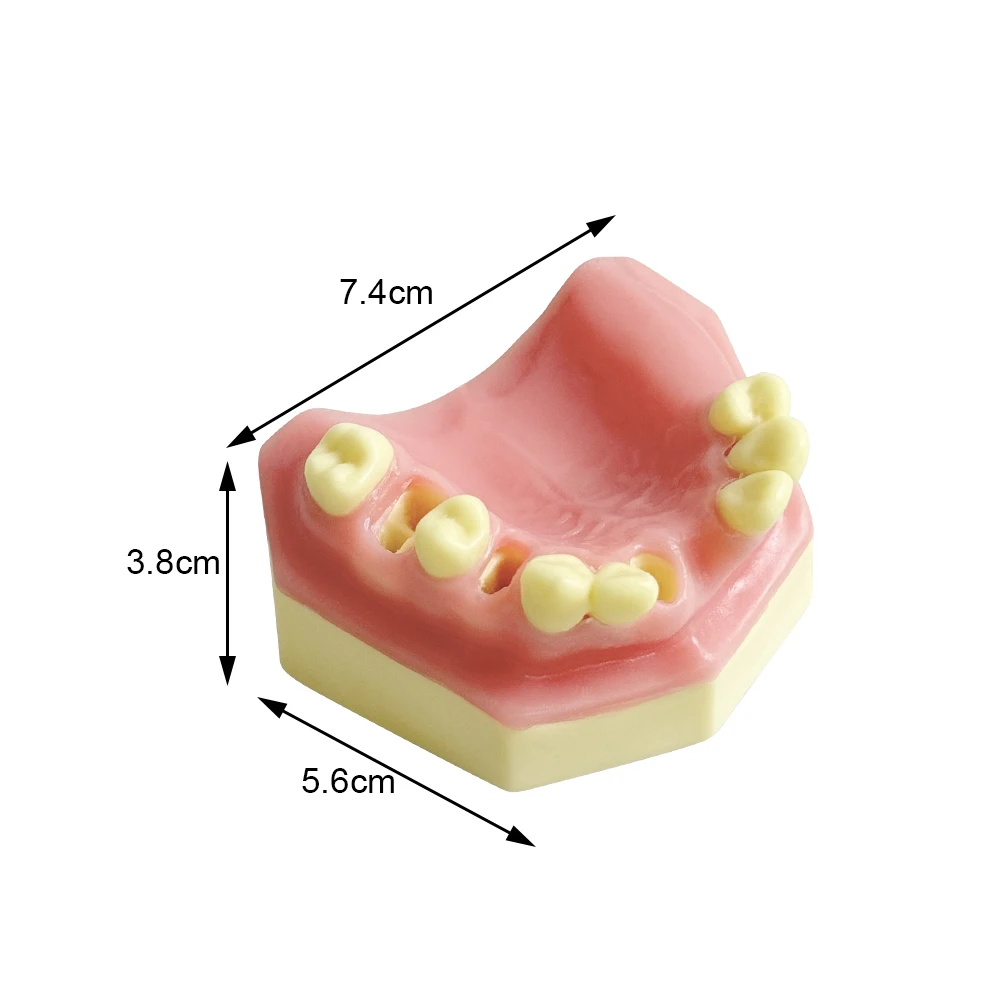 Dental Implant Teeth Model Dental Maxillary Sinus Implantation Practice Model With Missing Tooth Dentist Studying Demonstration
Dental Implant Teeth Model Dental Maxillary Sinus Implantation Practice Model With Missing Tooth Dentist Studying Demonstration