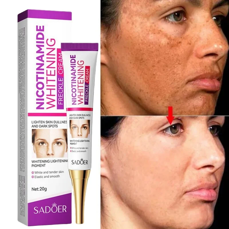 Effective Whitening Freckle Cream Remove Melasma Dark Spots Cream Fade Melanin Moisturize Brighten Smooth Beauty Face Skin Care
Effective Whitening Freckle Cream Remove Melasma Dark Spots Cream Fade Melanin Moisturize Brighten Smooth Beauty Face Skin Care