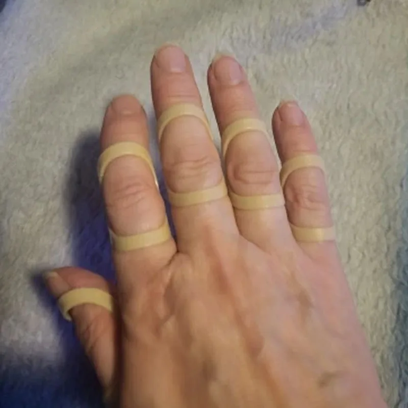 Adjustable 5PCS Finger Splint Bracket Protector Straightening Arthritis Finger Splint Fixed Broken Finger Joint Stabilizer
Adjustable 5PCS Finger Splint Bracket Protector Straightening Arthritis Finger Splint Fixed Broken Finger Joint Stabilizer