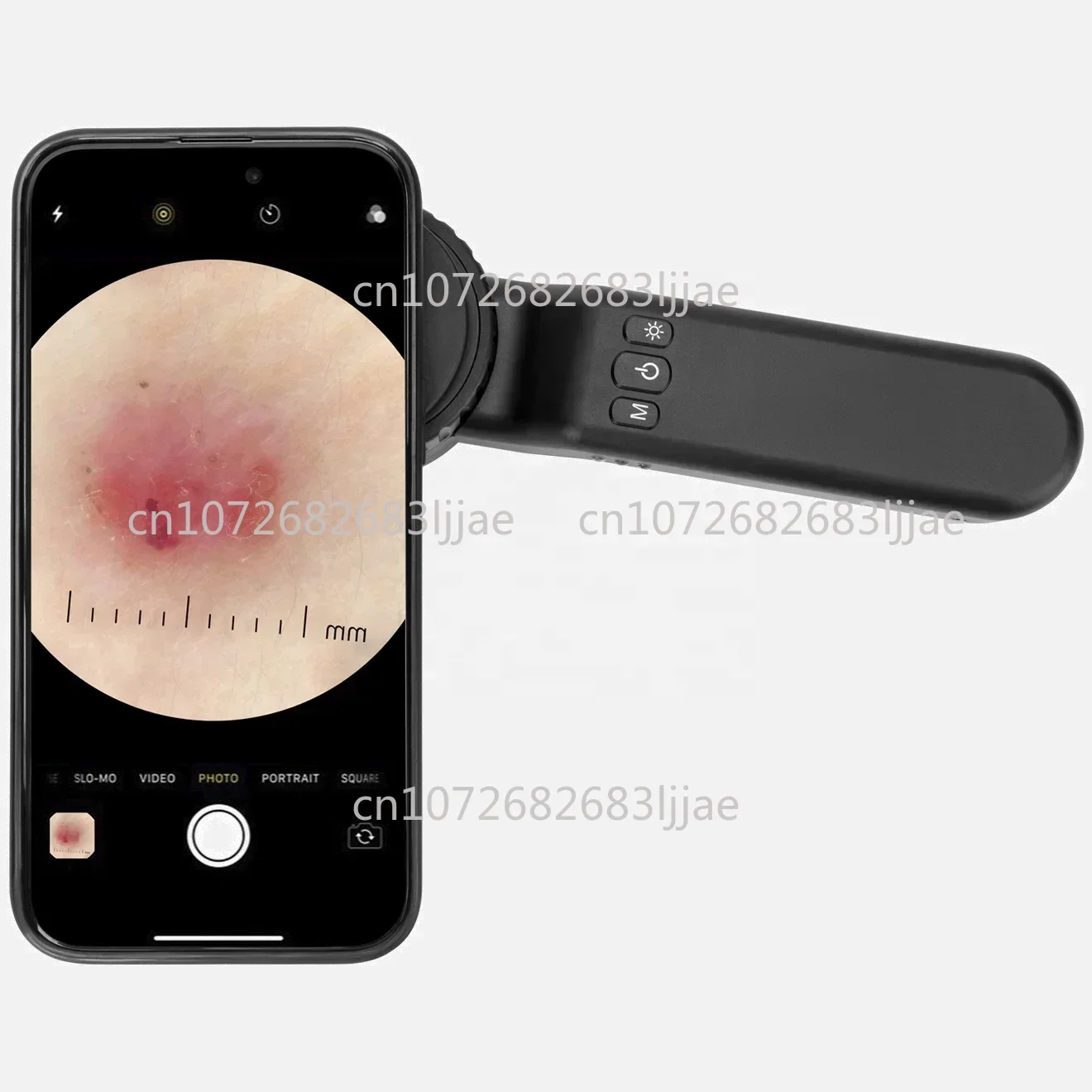 Best Seller FirstDE-4100 New Diagnostic Dermatoscope Optical 10x Zoom Dermatoscope, The World's Most Trusted Hand-held Dermatosc
Best Seller FirstDE-4100 New Diagnostic Dermatoscope Optical 10x Zoom Dermatoscope, The World's Most Trusted Hand-held Dermatosc