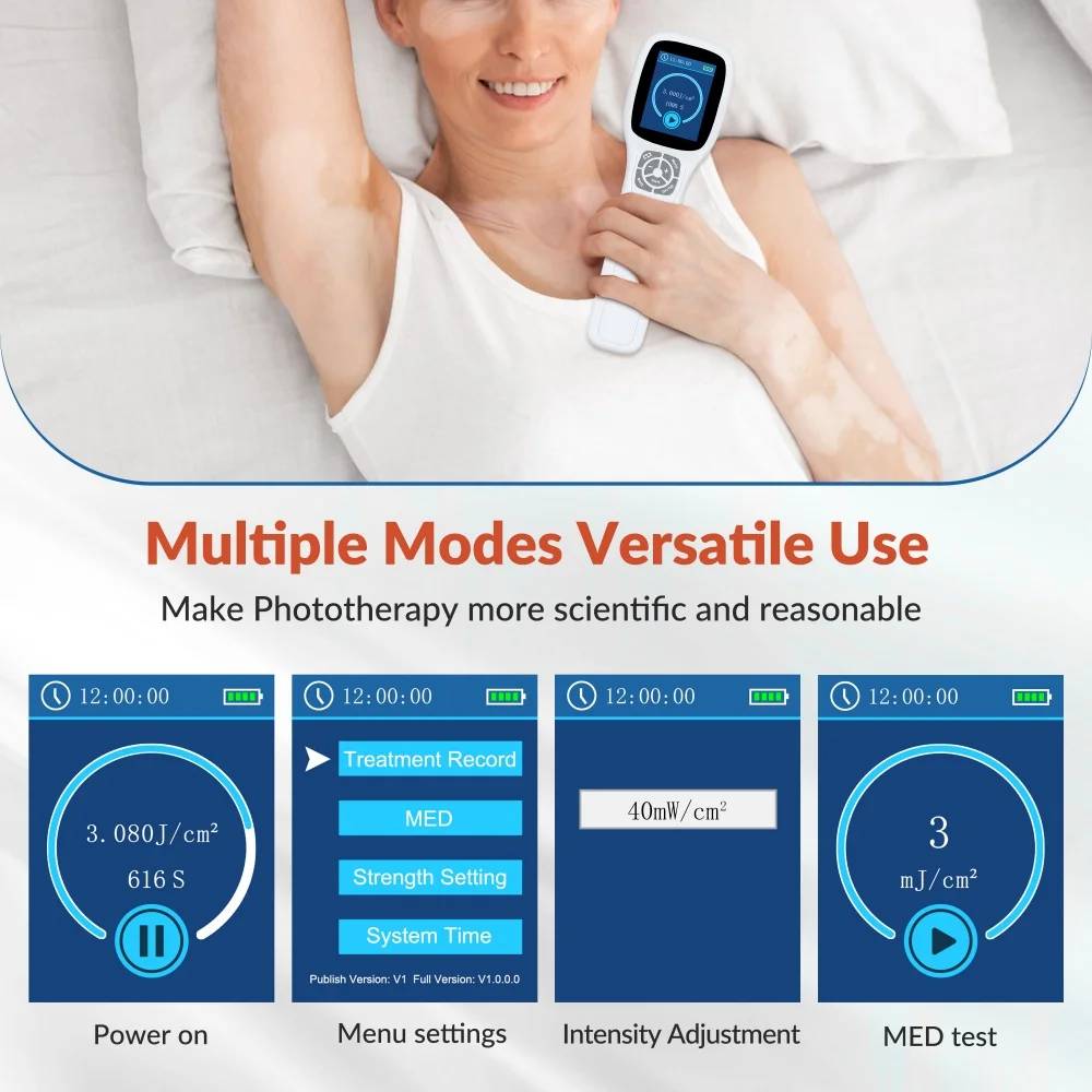 ZJZK Medical Grade 308nm Excimer Therapy Narrowband UVB Phototherapy for Eczema Vitiligo Skin Diseases Treatment Device 49Diodes
ZJZK Medical Grade 308nm Excimer Therapy Narrowband UVB Phototherapy for Eczema Vitiligo Skin Diseases Treatment Device 49Diodes