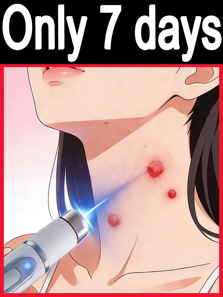 These inconspicuous little bumps not only affect ᵒⁿᵉ'ˢ ᵃᵖᵖᵉᵃʳᵃⁿᶜᵉ ᵇᵘᵗ ᵃˡˢᵒ ᶜᵃᵘˢᵉ ᵖᵃⁱⁿ‧
These inconspicuous little bumps not only affect ᵒⁿᵉ'ˢ ᵃᵖᵖᵉᵃʳᵃⁿᶜᵉ ᵇᵘᵗ ᵃˡˢᵒ ᶜᵃᵘˢᵉ ᵖᵃⁱⁿ‧