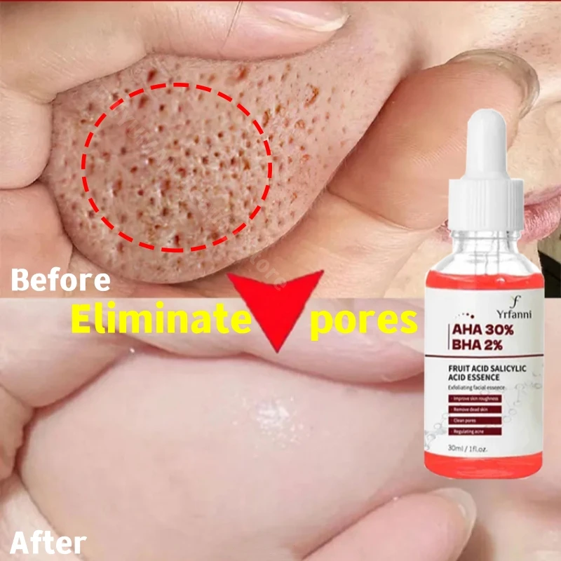 Fruit Acid Pore Shrinking Serum Face Powerful Tighten Large Pores Remove Dark Spot Purify Pore Whitening For Glowing Beauty Skin
Fruit Acid Pore Shrinking Serum Face Powerful Tighten Large Pores Remove Dark Spot Purify Pore Whitening For Glowing Beauty Skin