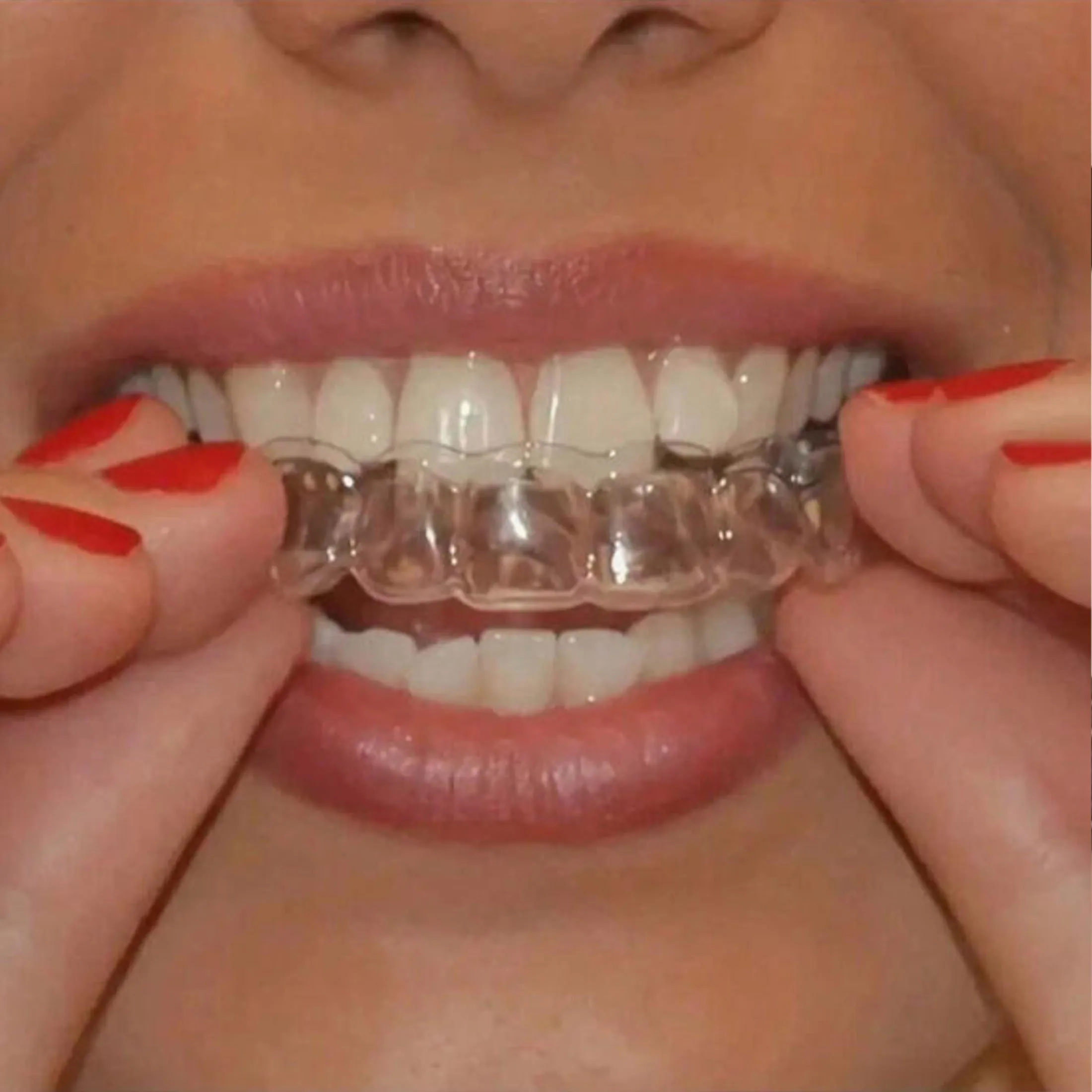 2 pieces of women's teeth protectors - anti-grinding sleep dental guards
2 pieces of women's teeth protectors - anti-grinding sleep dental guards