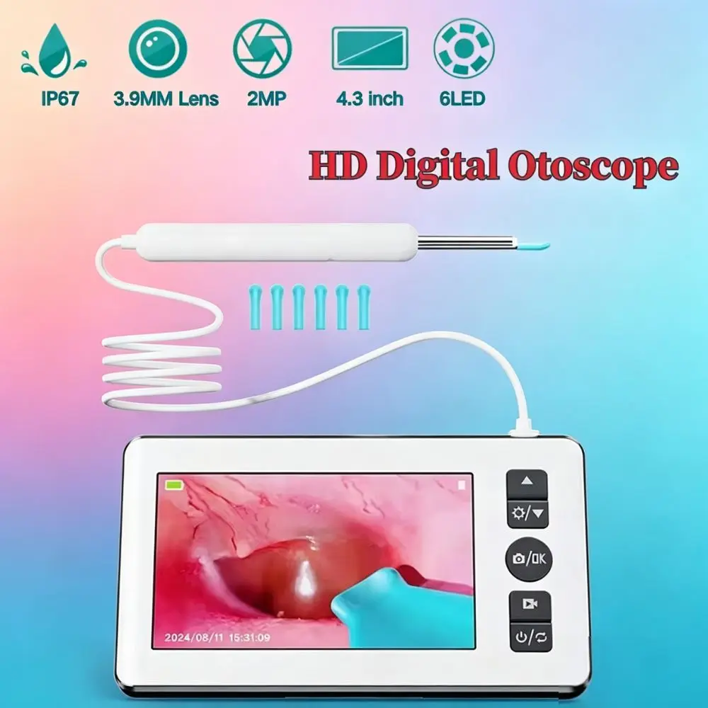 1080p HD Digital Otoscope with 4.3 Inch Screen Smart Vision Ear Camera Earwax Removal Tool for Kids Adult Pets
1080p HD Digital Otoscope with 4.3 Inch Screen Smart Vision Ear Camera Earwax Removal Tool for Kids Adult Pets