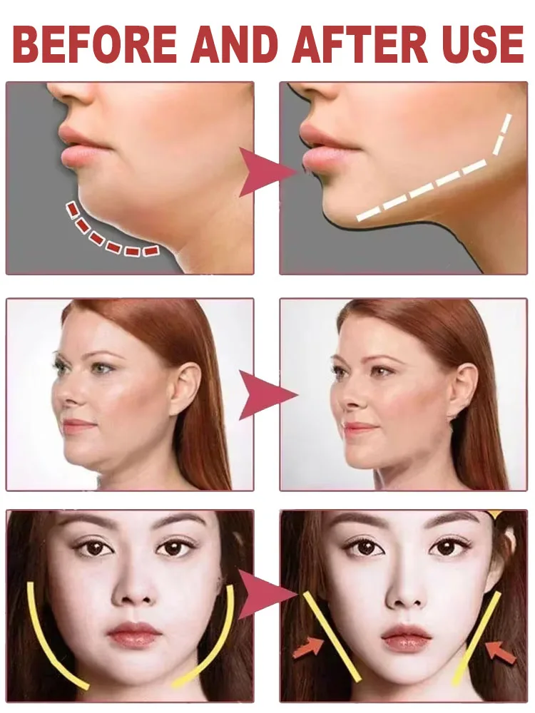 New facial cream to remove double chin tighten and lift V face care products
New facial cream to remove double chin tighten and lift V face care products
