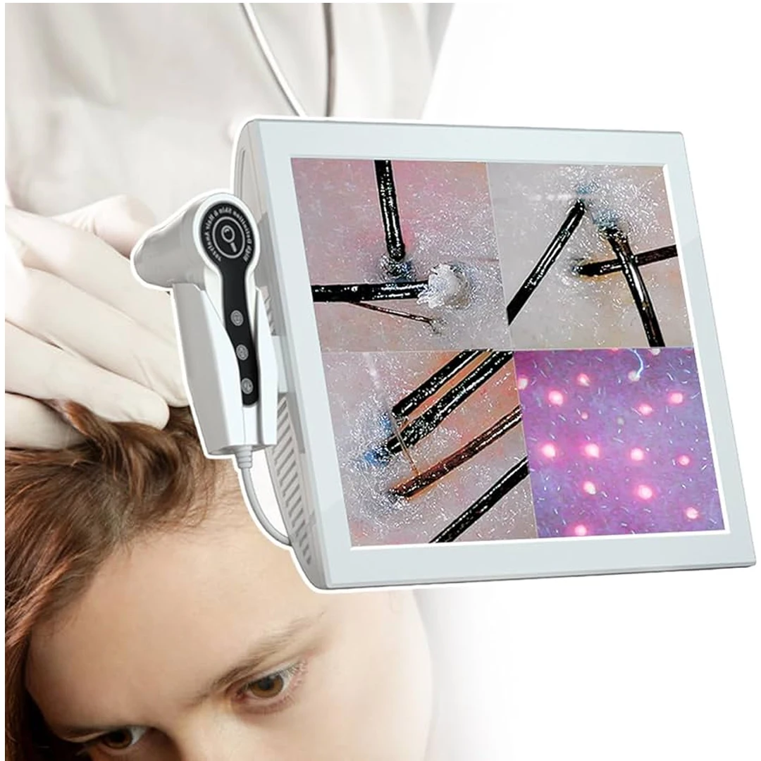Skin Diagnostic Hair Analyzer, 15-inch Skin Scalp Detector MultiFunctional Hair Follicle Analyser Machine with 50x/200x Dual Hea
Skin Diagnostic Hair Analyzer, 15-inch Skin Scalp Detector MultiFunctional Hair Follicle Analyser Machine with 50x/200x Dual Hea