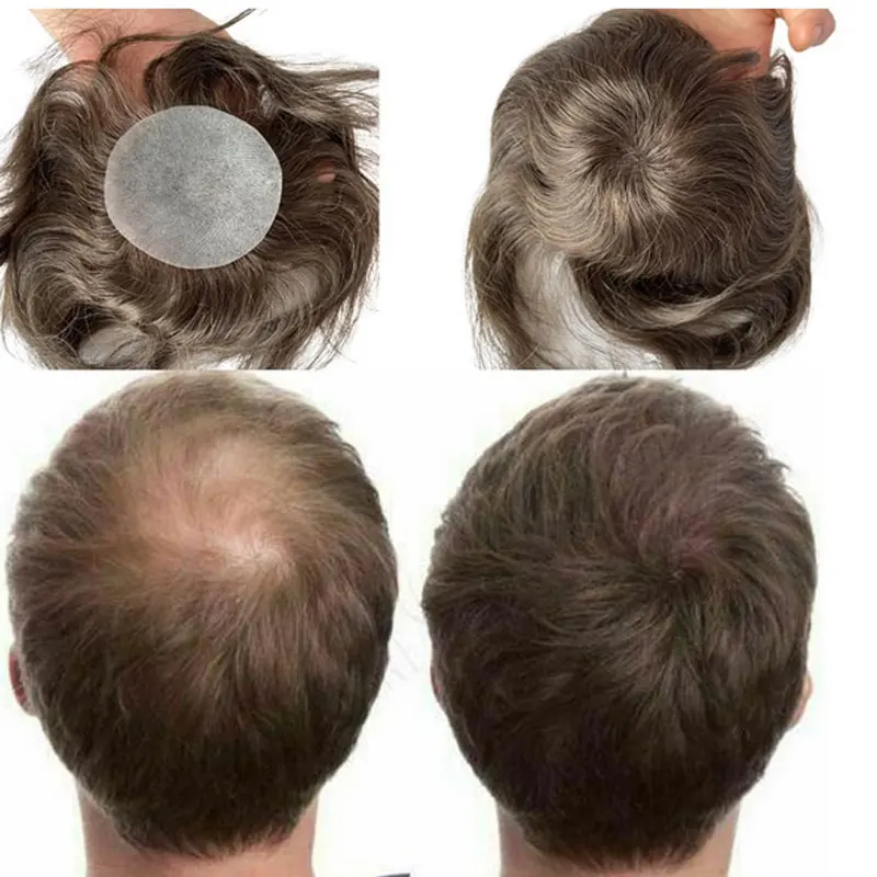 Brown Color Full PU Skin Base Bald Spot Hair Patch Toupee Human Hair Topper Cover-up Replacement Systems Hairpiece 8x8cm
Brown Color Full PU Skin Base Bald Spot Hair Patch Toupee Human Hair Topper Cover-up Replacement Systems Hairpiece 8x8cm