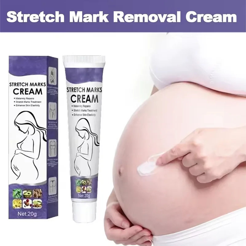 Stretch Mark Repair Cream For Pregnant Women Postpartum Care Firm Light Lines Obesity Lines Growth Lines Repair Cream New 
Stretch Mark Repair Cream For Pregnant Women Postpartum Care Firm Light Lines Obesity Lines Growth Lines Repair Cream New