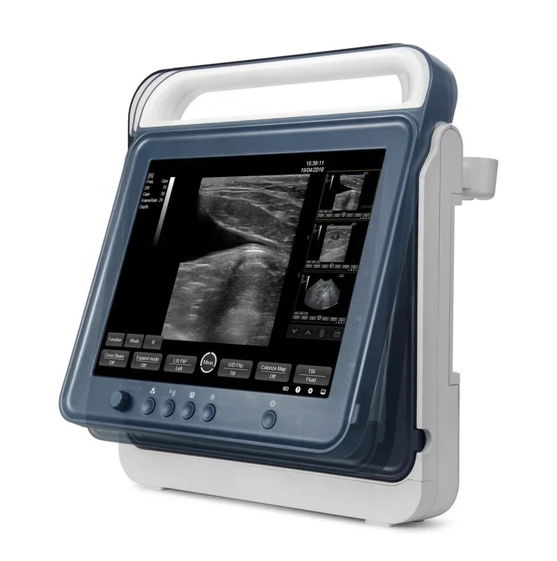 Portable Vet Ultrasound Machine With Touch Screen Model MSLVU40 For Veterinary Use
Portable Vet Ultrasound Machine With Touch Screen Model MSLVU40 For Veterinary Use