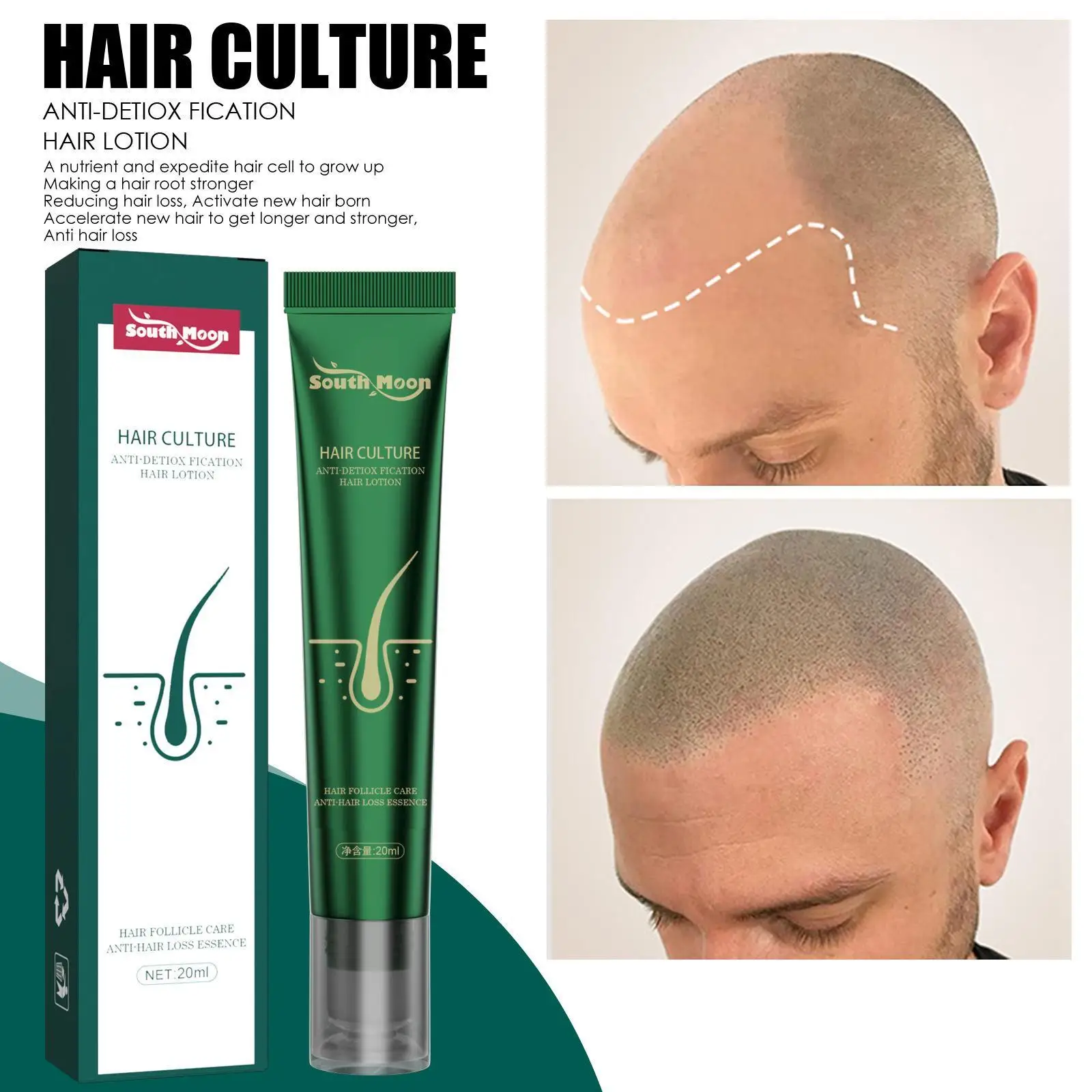 10/5/3/1Pcs Anti-hair Loss Treatment Liquid Fast Strengthens Hair Root Damage Repair Prevent Breaking Ginger
10/5/3/1Pcs Anti-hair Loss Treatment Liquid Fast Strengthens Hair Root Damage Repair Prevent Breaking Ginger