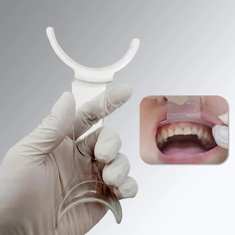 Mouth Expand Lip Retractor Intraoral Cheek Upper Lower Lip Retractor Dental Mouths Openers Orthodontic Dentist Tools
Mouth Expand Lip Retractor Intraoral Cheek Upper Lower Lip Retractor Dental Mouths Openers Orthodontic Dentist Tools