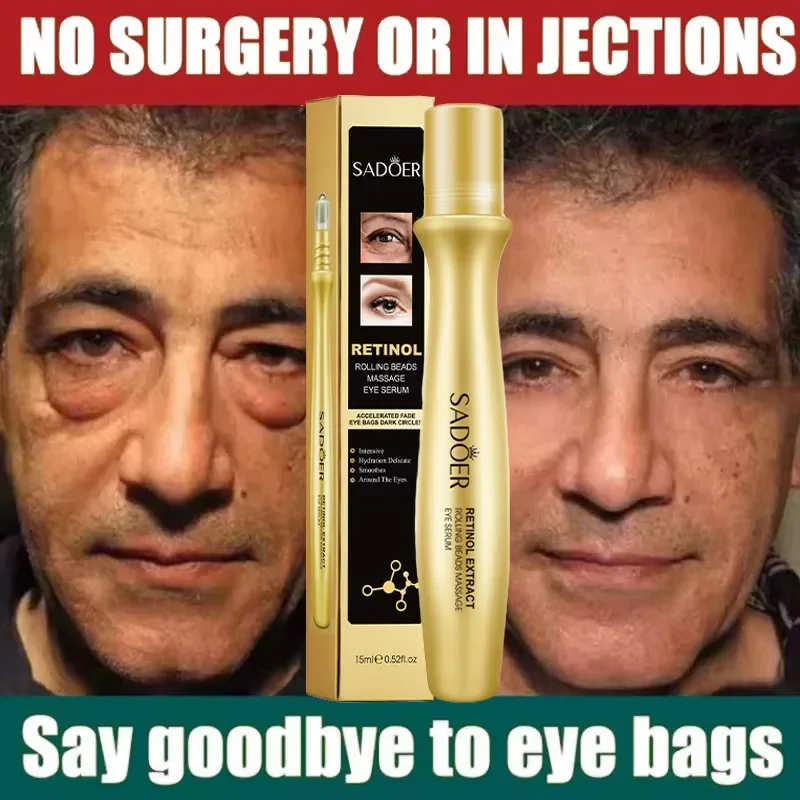 Instant Eye Bag Removal Rolling Beads Massage Serum Retinol Anti-Wrinkle Firm Skin Anti Dark Circle Puffiness Brighten Eye Care
Instant Eye Bag Removal Rolling Beads Massage Serum Retinol Anti-Wrinkle Firm Skin Anti Dark Circle Puffiness Brighten Eye Care