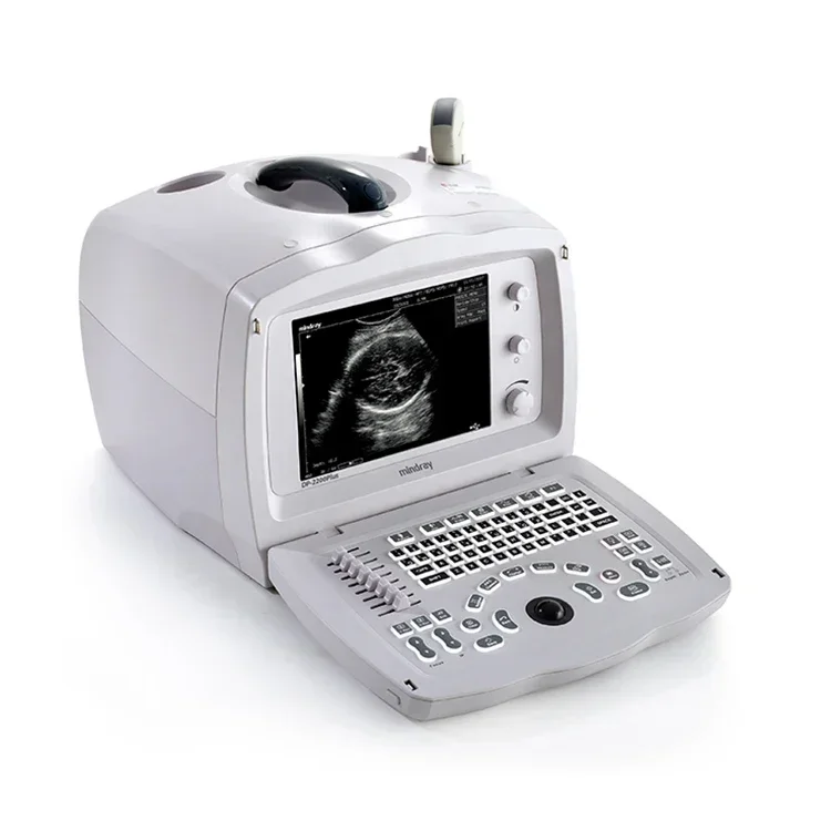 Недорогие медицинские ультразвуковые инструменты Mindray DP 2200 PLUS с цифровым изображением, черно-белые, портативная машина, китайская цена
Недорогие медицинские ультразвуковые инструменты Mindray DP 2200 PLUS с цифровым изображением, черно-белые, портативная машина, китайская цена