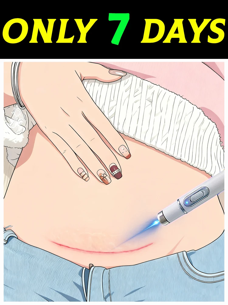 Lsaziнеады
Lsaziнеады