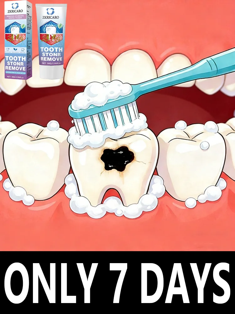 Aɴᴛɪ-ᴄᴀᴠɪᴛʏ ᴛʀᴇᴀᴛᴍᴇɴᴛ, ʀᴇᴍᴏᴠᴇs plaque and tartar ɪɴ 5 ᴅᴀʏs
Aɴᴛɪ-ᴄᴀᴠɪᴛʏ ᴛʀᴇᴀᴛᴍᴇɴᴛ, ʀᴇᴍᴏᴠᴇs plaque and tartar ɪɴ 5 ᴅᴀʏs