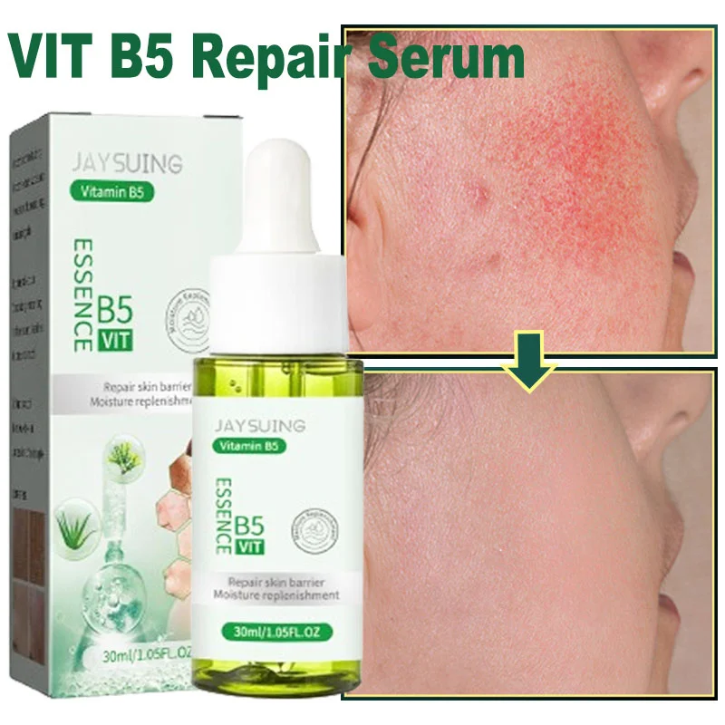 Vitamin B5 Serum Face Repair Anti Redness Soothing Moisturizing Shrinking Pores Skin Rejuvenation Care Beauty Korean Cosmetics
Vitamin B5 Serum Face Repair Anti Redness Soothing Moisturizing Shrinking Pores Skin Rejuvenation Care Beauty Korean Cosmetics
