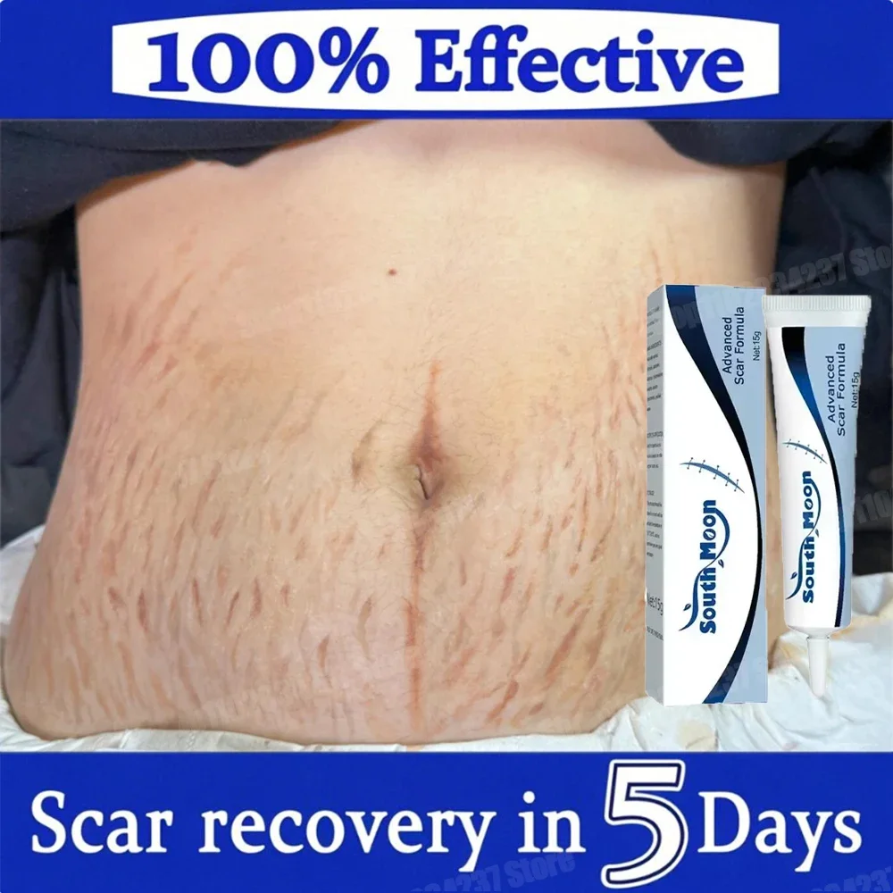 Stretch Marks Skin Care For Pregnant Women Natural Skin Care For Pregnant Women Firmness Smooth Improves Skin
Stretch Marks Skin Care For Pregnant Women Natural Skin Care For Pregnant Women Firmness Smooth Improves Skin
