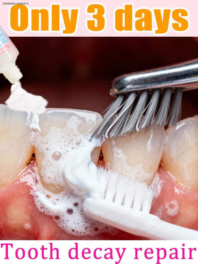 Эффективная чистка полости рта и восстановление зубов за 3 дня
Эффективная чистка полости рта и восстановление зубов за 3 дня