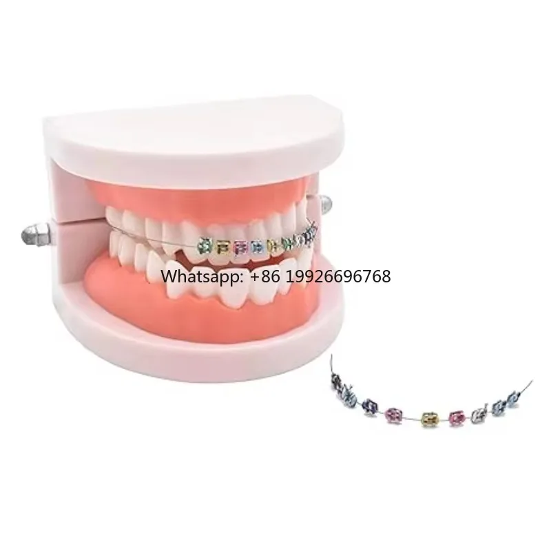 Fast Shipping Orthodontic Metal Bracket Kit with Colorful Crowns Manual Power Source Fashionable False Teeth Braces for Teeth Li
Fast Shipping Orthodontic Metal Bracket Kit with Colorful Crowns Manual Power Source Fashionable False Teeth Braces for Teeth Li