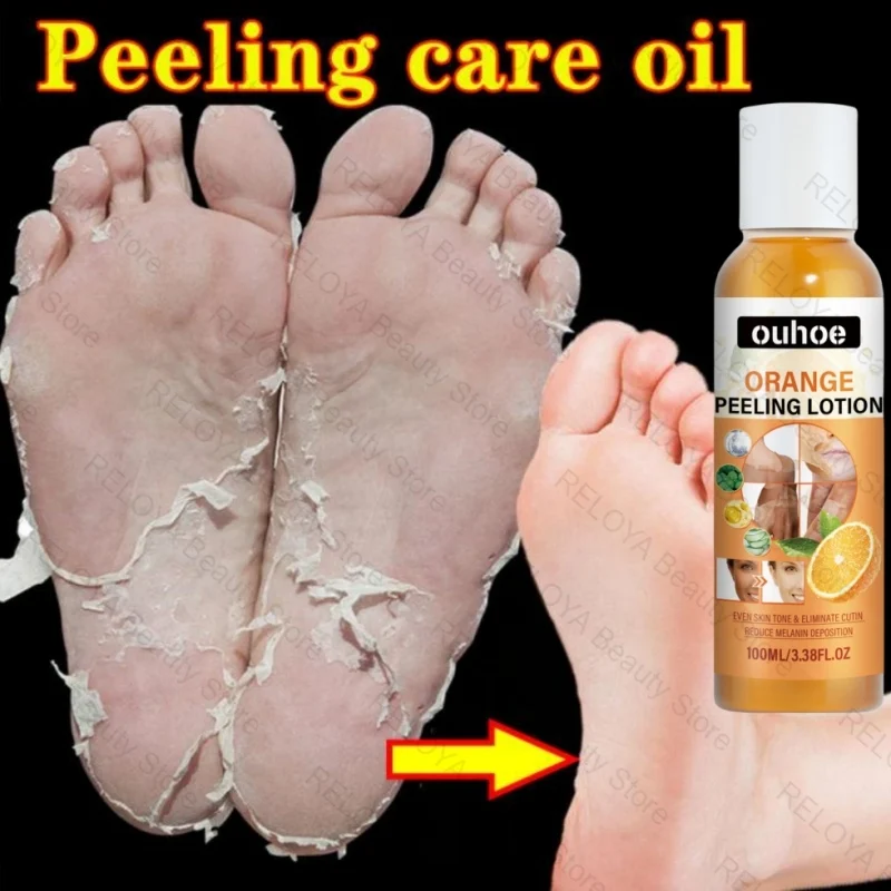 Yellow Peeling Oil Bleaching Face Body Dark Skin Brighten Whiten Lotion Hand Foot Dead Skin Peel Exfoliate Nourish New Skin Tone
Yellow Peeling Oil Bleaching Face Body Dark Skin Brighten Whiten Lotion Hand Foot Dead Skin Peel Exfoliate Nourish New Skin Tone