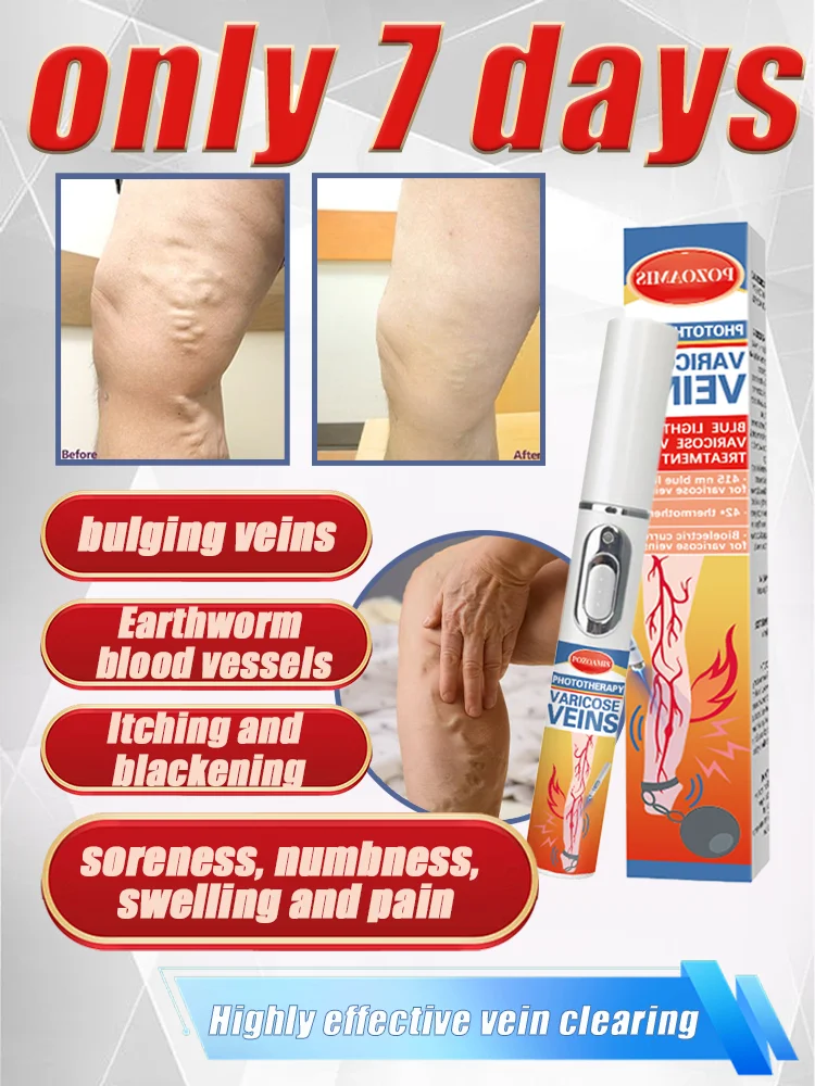 Мягко улучшают варикозное расширение вен! Просто несколько минут в день, чтобы подарить свои ноги, нежный уход.
Мягко улучшают варикозное расширение вен! Просто несколько минут в день, чтобы подарить свои ноги, нежный уход.