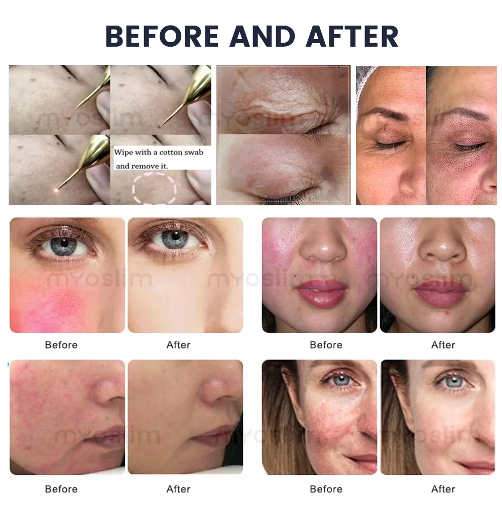 VIP Shipping / customs charges supplement
VIP Shipping / customs charges supplement