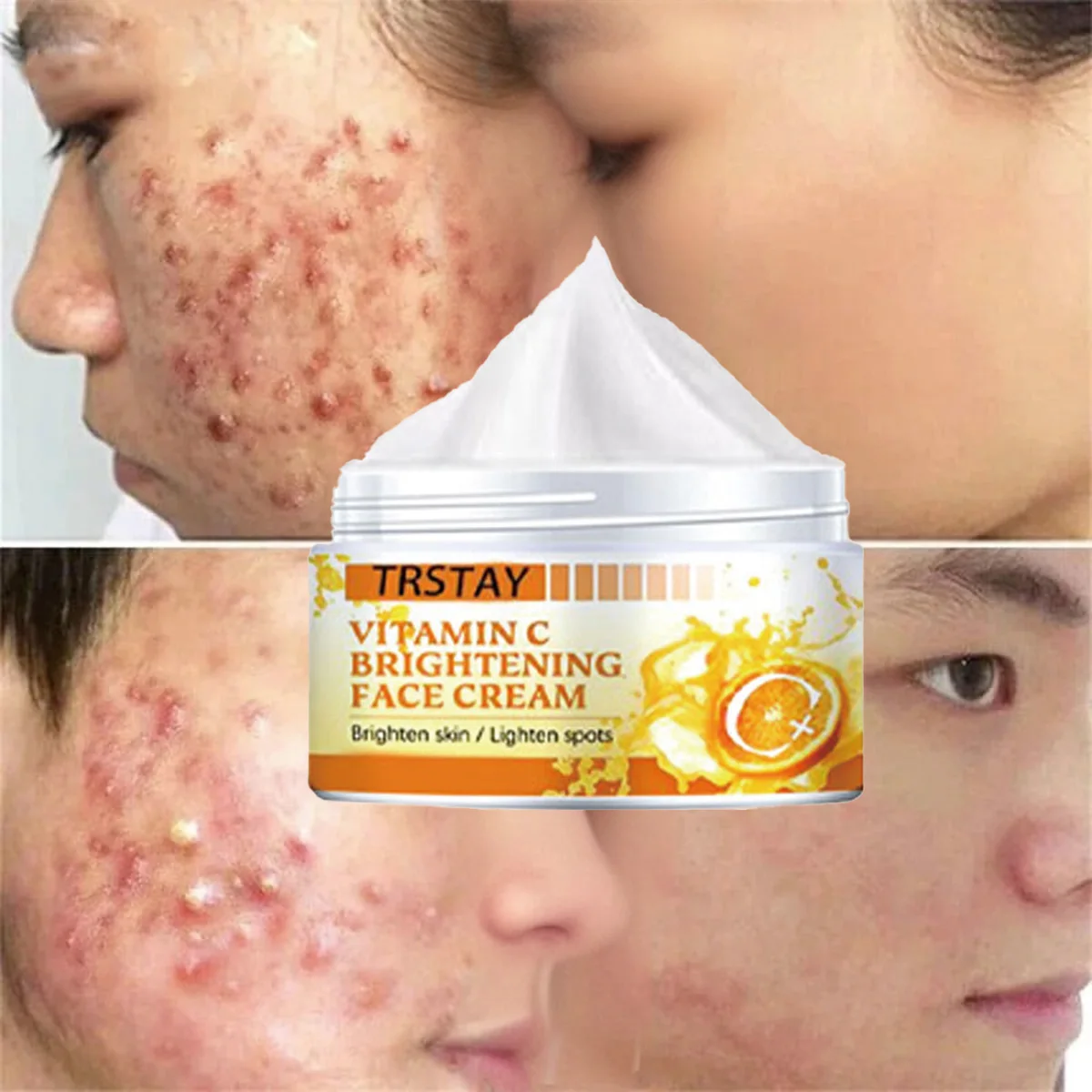TRSTAY Осветляющий кожу крем для лица с витамином С - Отбеливающий пятно, осветляющий морщины, увлажняющий, укрепляющий для ухода за лицом
TRSTAY Осветляющий кожу крем для лица с витамином С - Отбеливающий пятно, осветляющий морщины, увлажняющий, укрепляющий для ухода за лицом