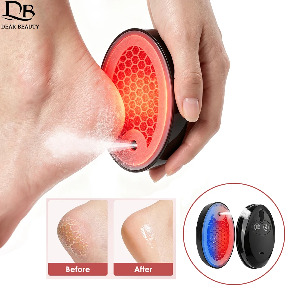 Electric Foot Grinder Exfoliator Feet File Callus And Dead Skin Remover Built-in Mist Spray Smooth Hydrating Foot Care SPA Tools
Electric Foot Grinder Exfoliator Feet File Callus And Dead Skin Remover Built-in Mist Spray Smooth Hydrating Foot Care SPA Tools