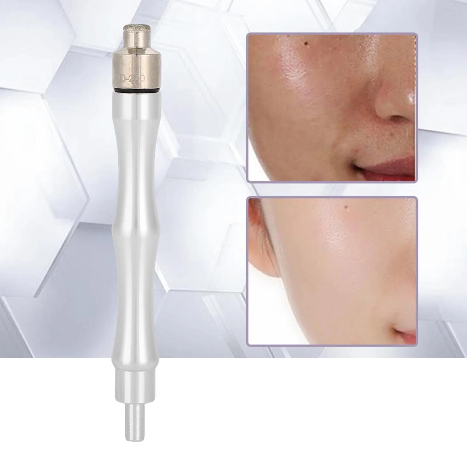 Replacement Dermabrasion Tips Filter Replacement Microdermabrasion Dermabrasion Tips with Handle Stainless Steel Filter Set
Replacement Dermabrasion Tips Filter Replacement Microdermabrasion Dermabrasion Tips with Handle Stainless Steel Filter Set