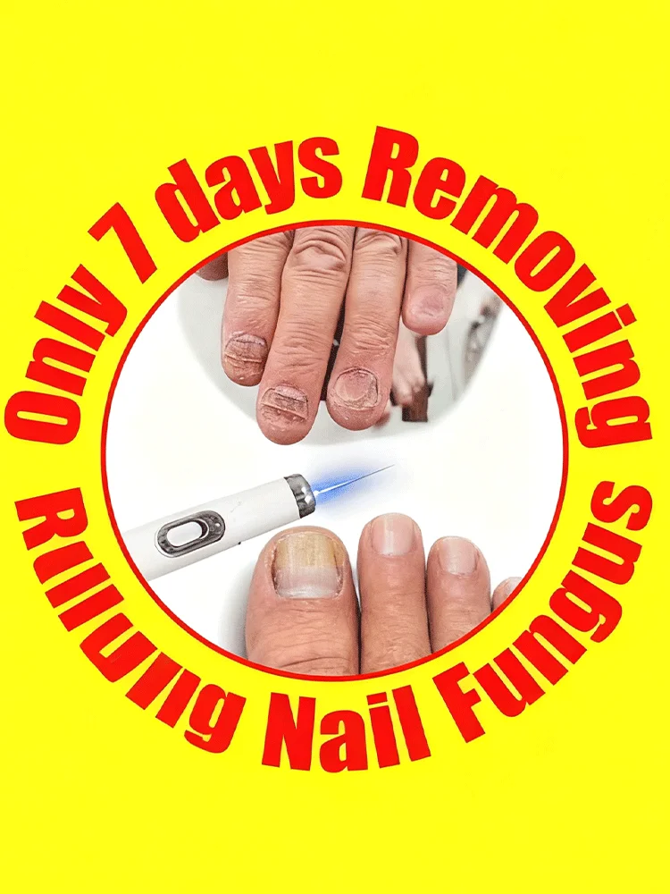 2025 New Blue Laser care Nail Fungi
2025 New Blue Laser care Nail Fungi