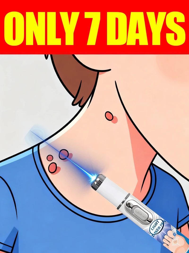 Синий световой карандаш для удаления шипов на шее, инструменты для ухода за подмышечными бородавками
Синий световой карандаш для удаления шипов на шее, инструменты для ухода за подмышечными бородавками