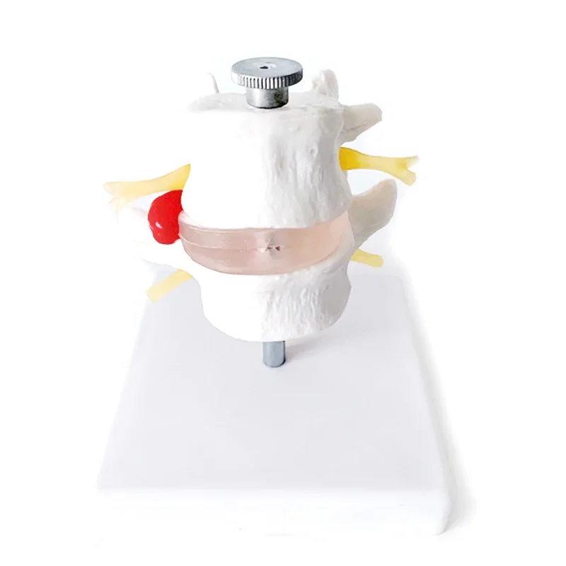 Vertebral lumbar disc herniation modelSpine modelHuman cervical spine model
Vertebral lumbar disc herniation modelSpine modelHuman cervical spine model